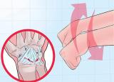 손목을 삐끗했을때 - 손목염좌 증상과 자가관리
