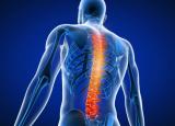 척추를 위협하는 5가지 질환, 원인과 증상 예방법 