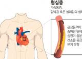 협심증 종류별 증상 - 안정형, 불안정형, 이형성 